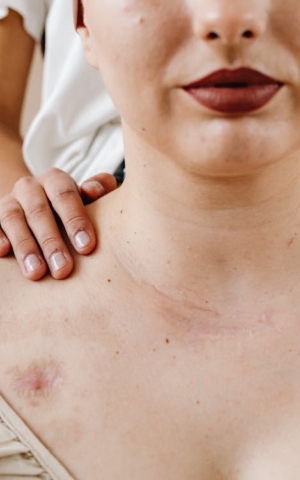 24 Scars and Wounds Quotes to Help You Heal When You're Hurting | The Health Sessions